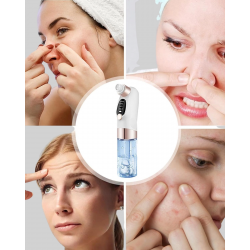 Mey İthalat® Ayarlanabilir Emiş Gücü ile Profesyonel Siyah Nokta Temizleyici