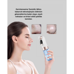 Mey İthalat® Elektrikli Siyah Nokta Sökücü – Derinlemesine Gözenek Temizleme Cihazı